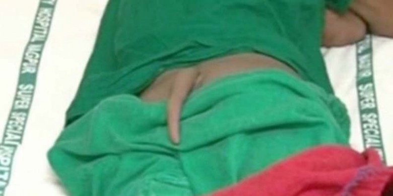 Remaja-India-Miliki-Ekor.jpg