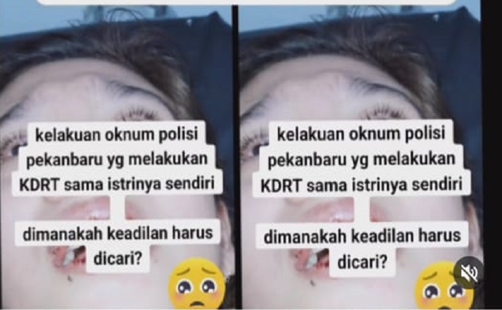 Diduga-istri-polisi-di-kdrt.jpg