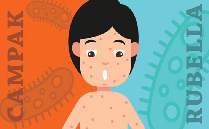 Ilustrasi-campak-rubella.jpg