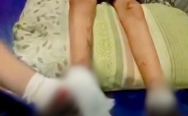 Korban-Dugaan-Perundungan-di-Inhil-Alami-Cedera-Kaki-Hingga-Menghitam.jpg