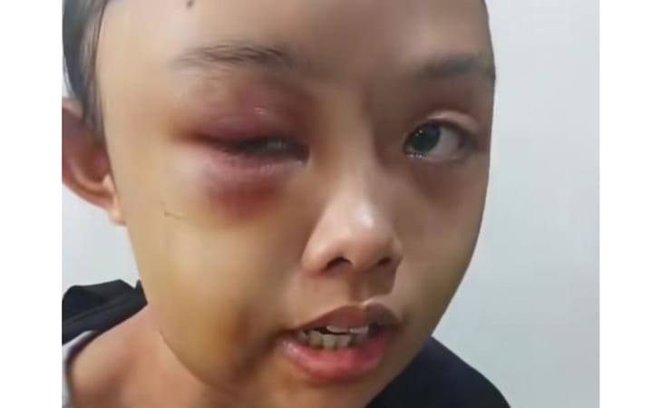 Ponakan-dianiaya-tante-di-kampar.jpg