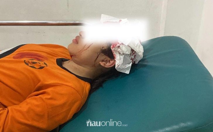 Tangga-Tangsi-Belanda-di-Siak-Roboh-Murid-SD-Jatuh-Hingga-Kepala-Bocor.jpg