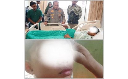 Anak-14-Tahun-dan-Mahasiswa-Diduga-Jadi-Korban-Kekerasan-Aparat-Era-Herry-Heryawan.jpg