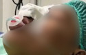 Hidung-Pelajar-di-Kampar-Diduga-Patah-Akibat-Dianiaya-Senior-Ibu-Minta-Polisi-Bertindak.jpg