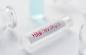 Ilustrasi-Hantavirus.jpg