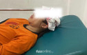Tangga-Tangsi-Belanda-di-Siak-Roboh-Murid-SD-Jatuh-Hingga-Kepala-Bocor.jpg
